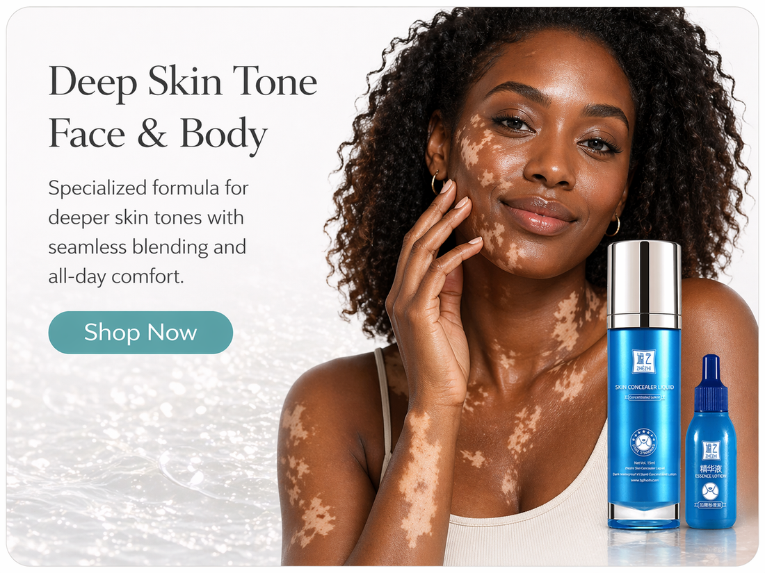 Vitiligo Is More Than Skin: Choice, Confidence and Everyday Life