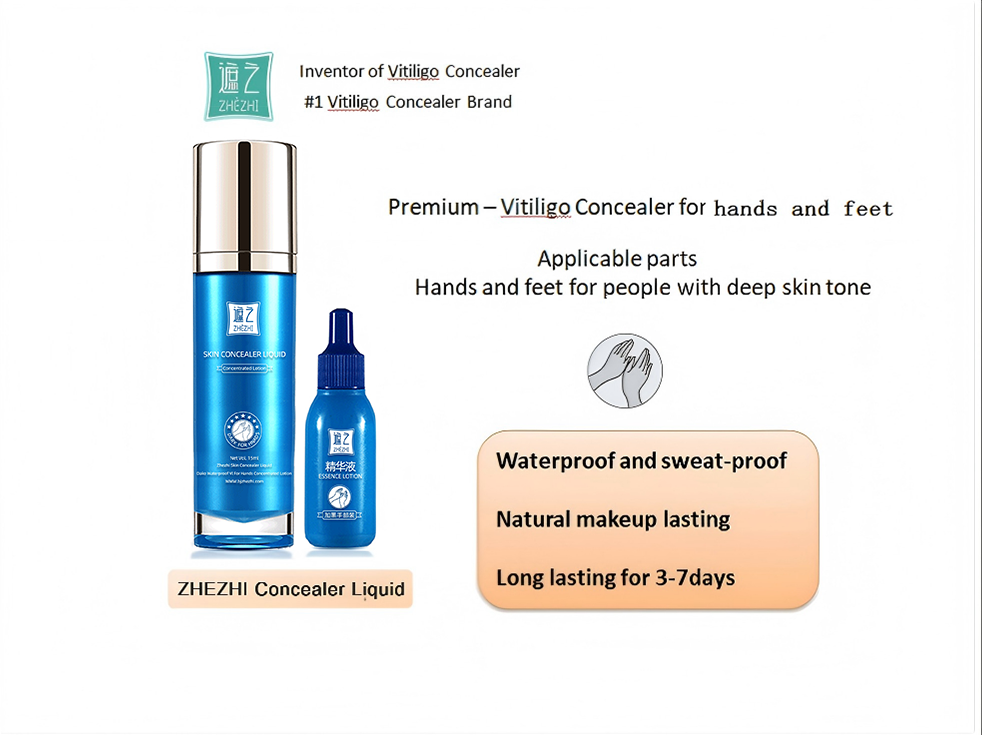 ZHEZHI Coverage Liquid 30ml – Large Area Vitiligo Coverage | 2 Shades for All Skin Tones