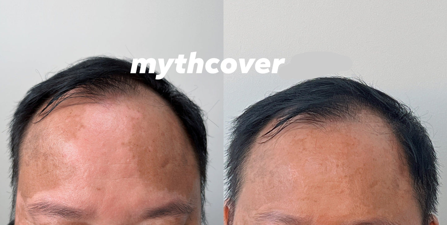 Waterproof vitiligo concealing liquid Plus-30ML
