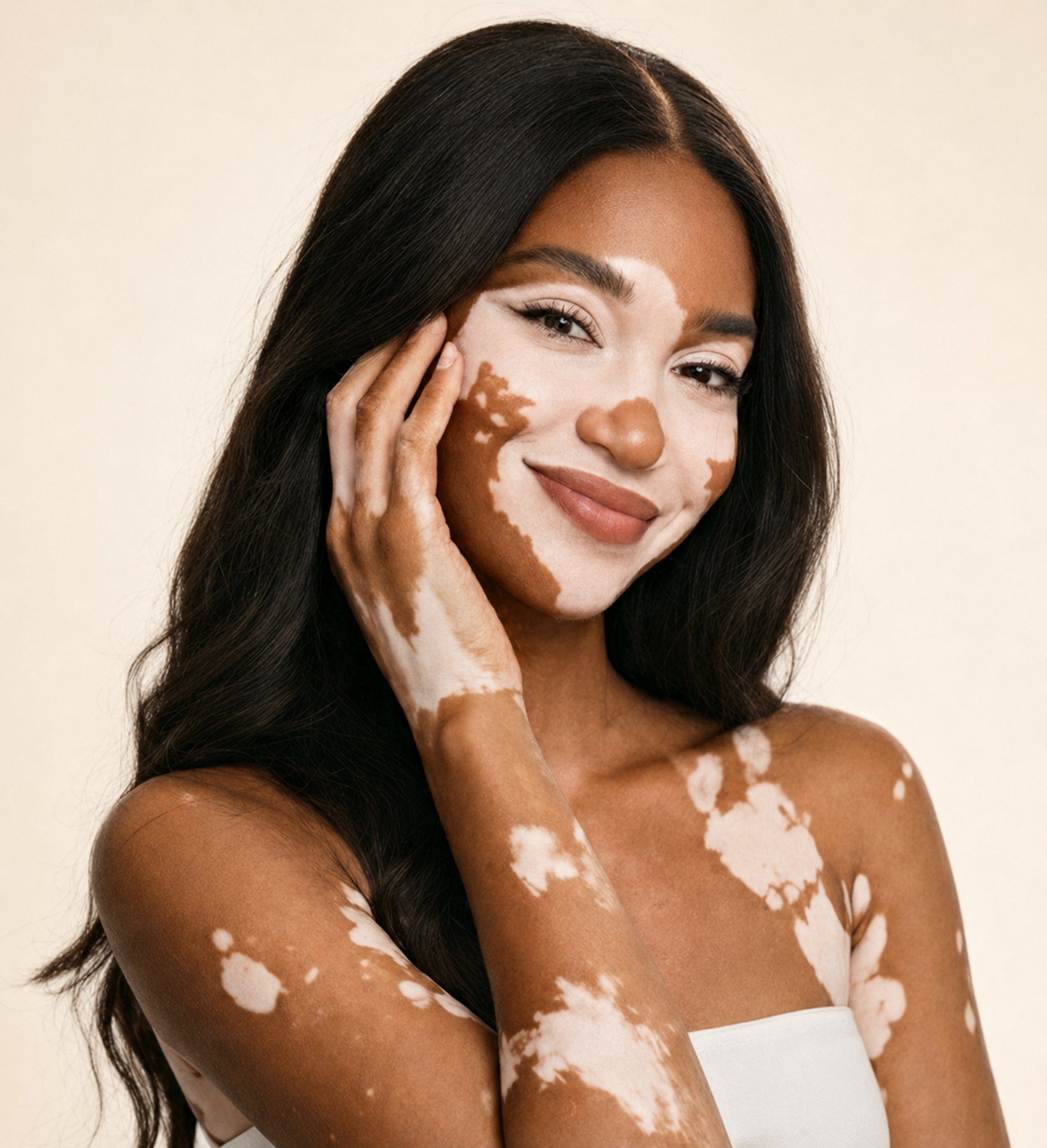 Model with vitiligo and visible white patches
